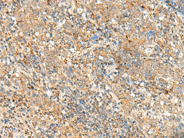 FKBP1A Polyclonal Antibody (E-AB-52794)