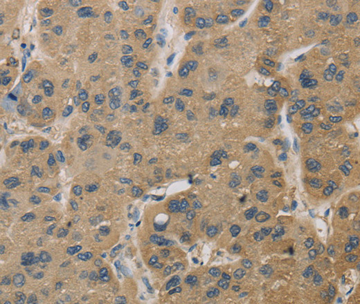 TBXAS1 Polyclonal Antibody (E-AB-11128)