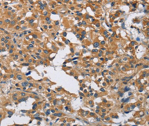 DNMT3A Polyclonal Antibody (E-AB-14623)