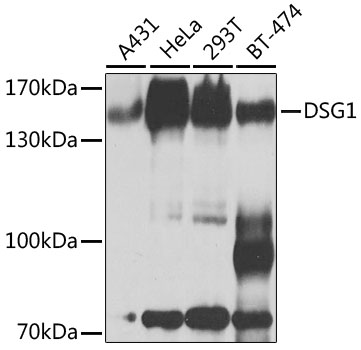 DSG1 Polyclonal Antibody (E-AB-68430)