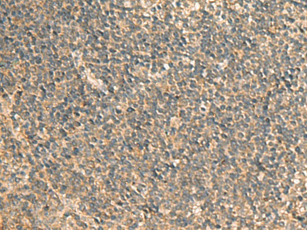 GPBP1 Polyclonal Antibody (E-AB-52833)