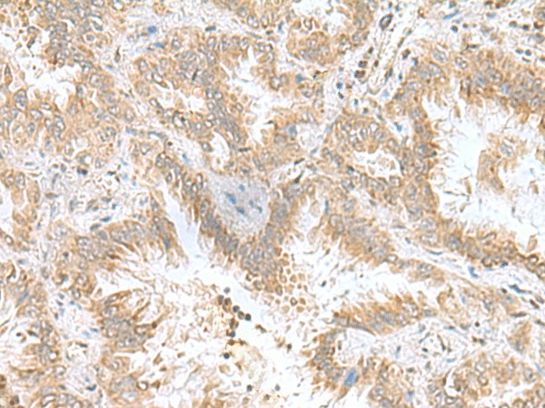 CPLX3 Polyclonal Antibody (E-AB-19133)