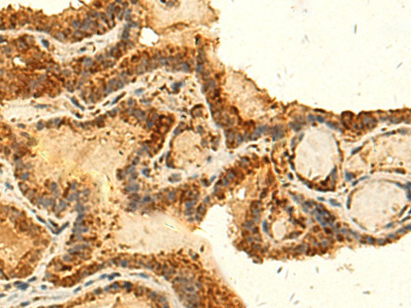 HS1BP3 Polyclonal Antibody (E-AB-52852)