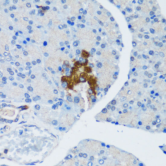 TSC1 Polyclonal Antibody (E-AB-62249)