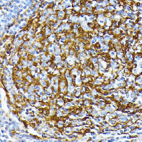 CSNK1A1 Polyclonal Antibody (E-AB-66730)
