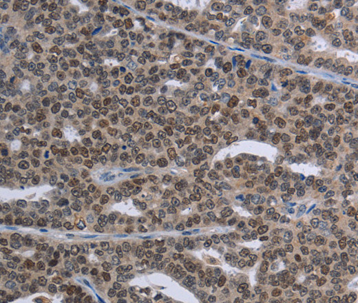 MAGEC1 Polyclonal Antibody (E-AB-13395)