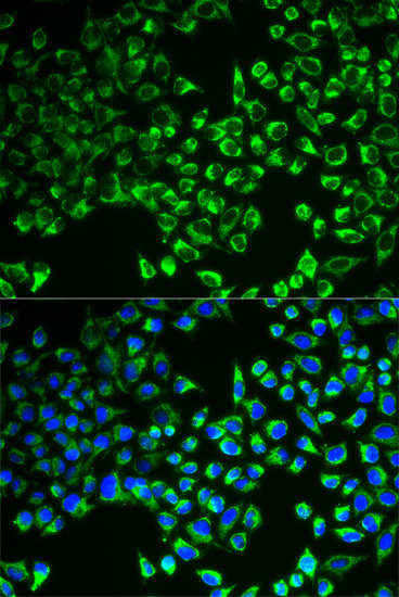 CS Polyclonal Antibody (E-AB-61080)