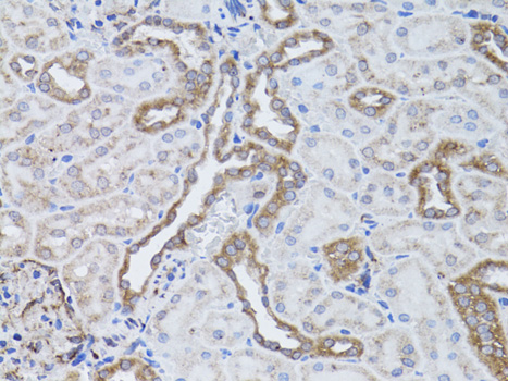 ITGAV Polyclonal Antibody (E-AB-60598)