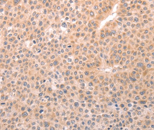 TRPC3 Polyclonal Antibody (E-AB-12913)