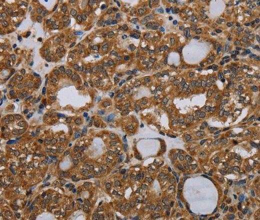 PARP8 Polyclonal Antibody (E-AB-16685)