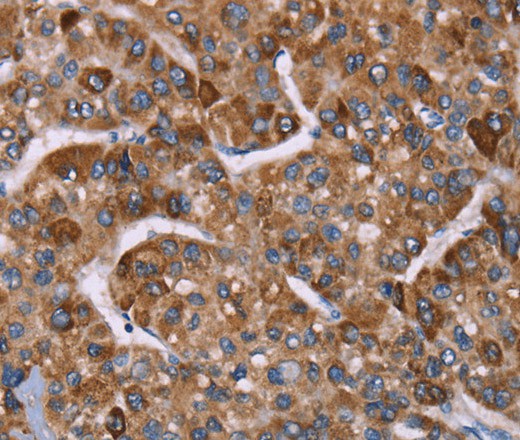 HSP10 Polyclonal Antibody (E-AB-16498)