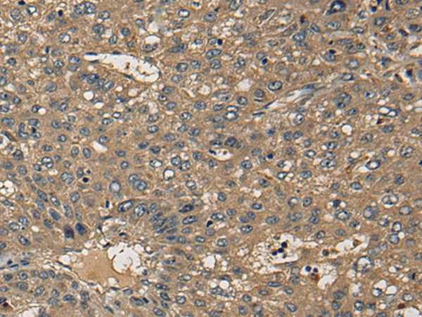 CD1B Polyclonal Antibody (E-AB-17775)