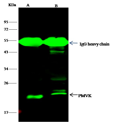 Recombinant PMVK/phosphomevalonate kinase Monoclonal Antibody (AN300282P)