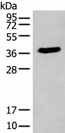 ACBD4 Polyclonal Antibody (E-AB-18352)