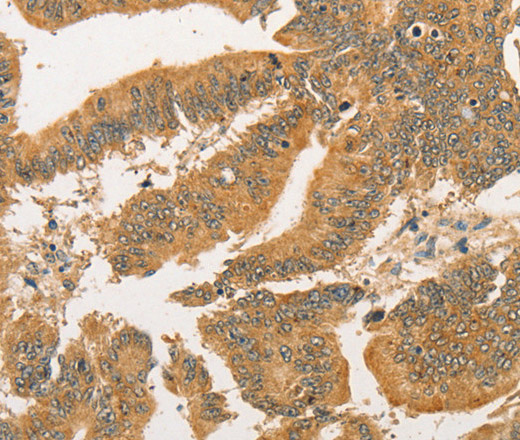 BCL2L14 Polyclonal Antibody (E-AB-10865)