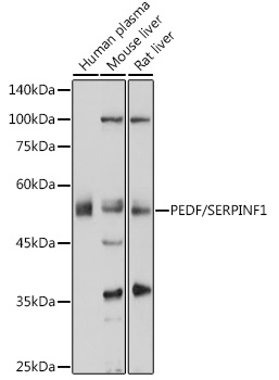 PEDF/SERPINF1 Polyclonal Antibody (E-AB-93068)