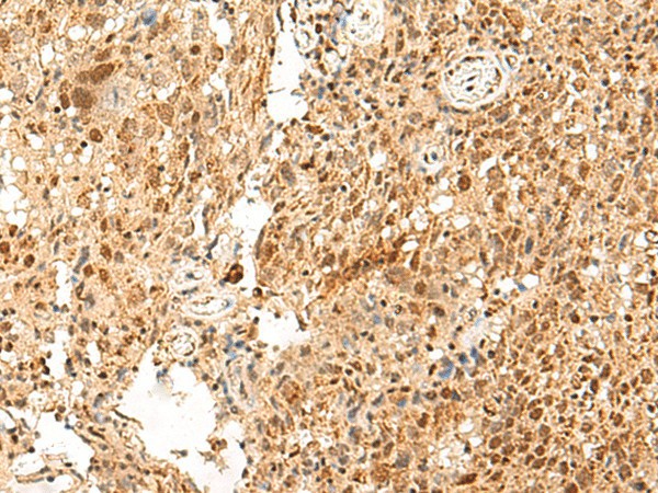 PAF1 Polyclonal Antibody (E-AB-52757)