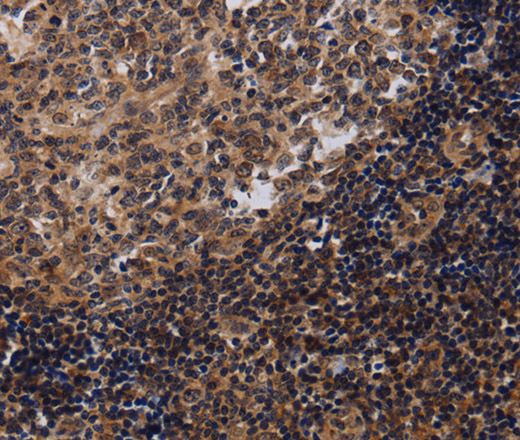 NTMT1 Polyclonal Antibody (E-AB-11390)