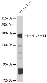 Dot1L/KMT4 Polyclonal Antibody (E-AB-90262)