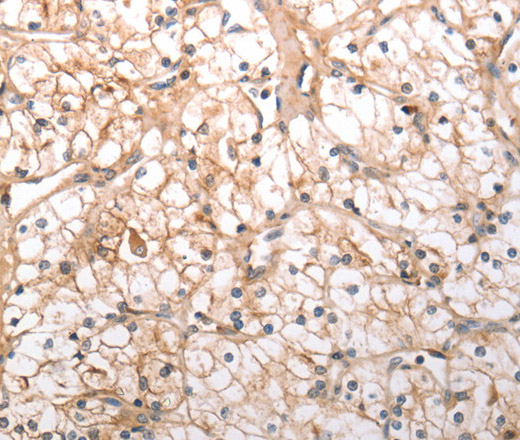 HCRTR1 Polyclonal Antibody (E-AB-16019)