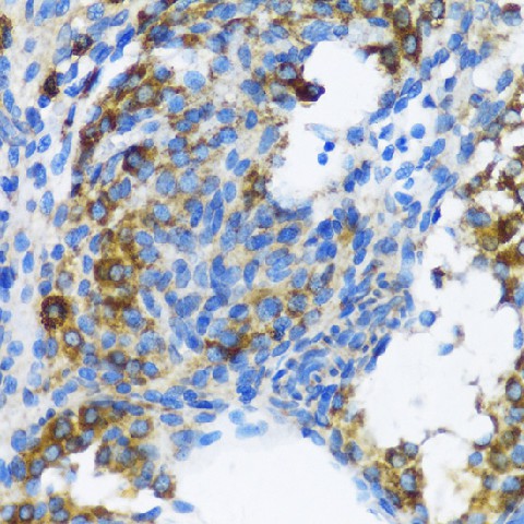 PTCH1 Polyclonal Antibody (E-AB-62186)