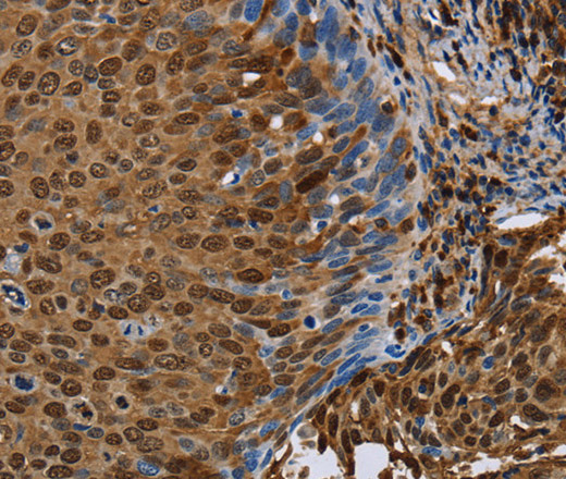 NRP2 Polyclonal Antibody (E-AB-13447)