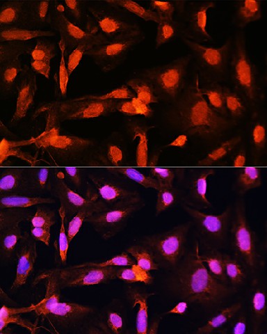 SGOL1 Polyclonal Antibody (E-AB-66712)