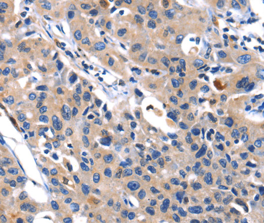 MMP16 Polyclonal Antibody (E-AB-10463)