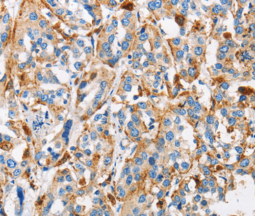Cathepsin L Polyclonal Antibody (E-AB-10211)