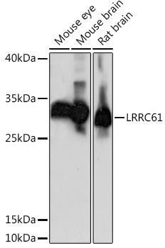 LRRC61 Polyclonal Antibody (E-AB-91060)