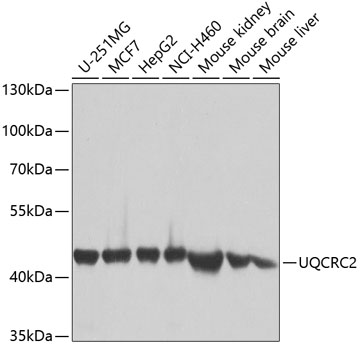 UQCRC2 Polyclonal Antibody (E-AB-62258)