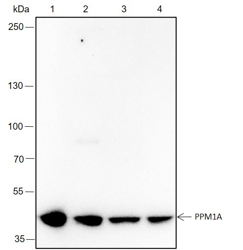 Recombinant PPM1A Monoclonal Antibody (AN301633L)