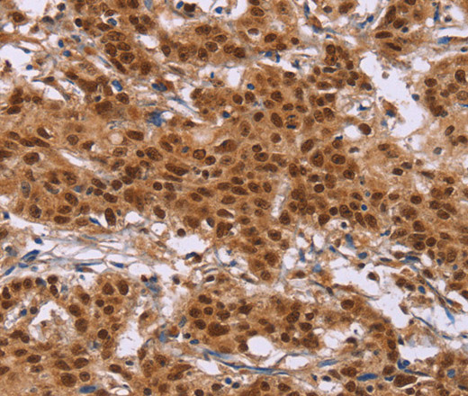 CTNNBL1 Polyclonal Antibody (E-AB-14901)