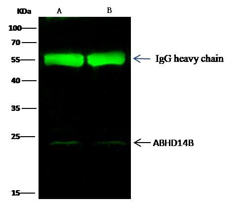 Recombinant ABHD14B Monoclonal Antibody (AN300273P)