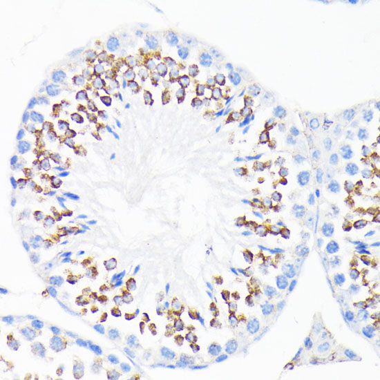 CAMP Polyclonal Antibody (E-AB-66800)
