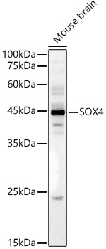 SOX4 Polyclonal Antibody (E-AB-90237)