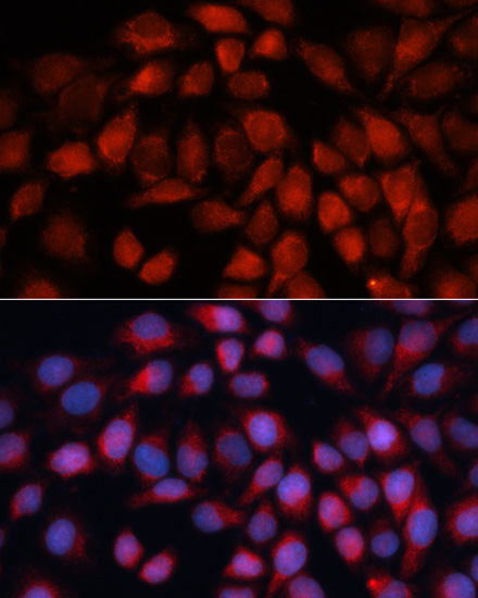 ACADM Polyclonal Antibody (E-AB-60486)