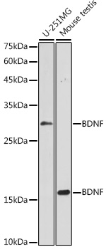 BDNF Polyclonal Antibody (E-AB-93151)