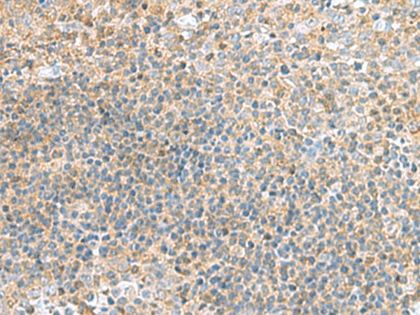 TSTA3 Polyclonal Antibody (E-AB-19231)