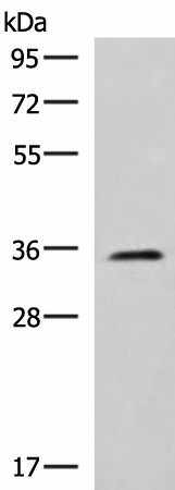 JAM3 Polyclonal Antibody (E-AB-52059)