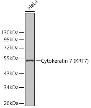 KRT7 Polyclonal Antibody (E-AB-67476)