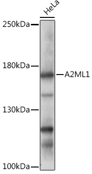 A2ML1 Polyclonal Antibody (E-AB-91925)