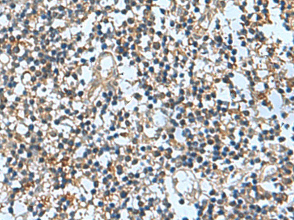 TRO Polyclonal Antibody (E-AB-19090)