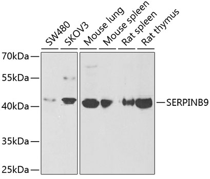 SERPINB9 Polyclonal Antibody (E-AB-61928)