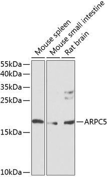 ARPC5 Polyclonal Antibody (E-AB-63020)