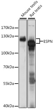 ESPN Polyclonal Antibody (E-AB-91343)