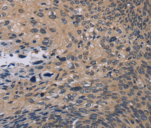 NOX1 Polyclonal Antibody (E-AB-16653)
