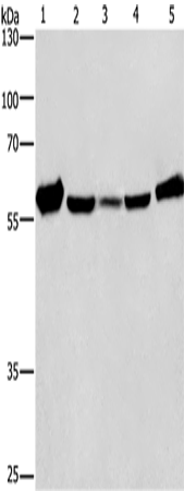 CAT Polyclonal Antibody (E-AB-11036)