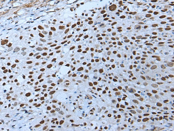 ZNHIT3 Polyclonal Antibody (E-AB-19558)