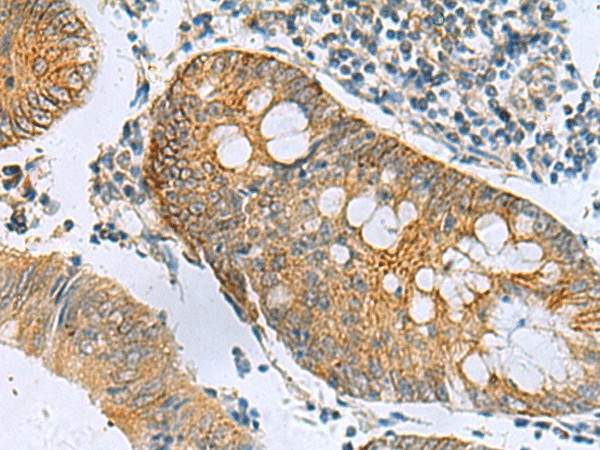 GUCA1A Polyclonal Antibody (E-AB-19163)